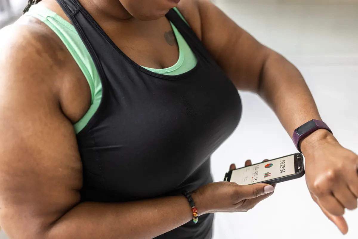 Frau mit möglichem Lipödem